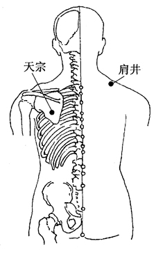 图5-7-1